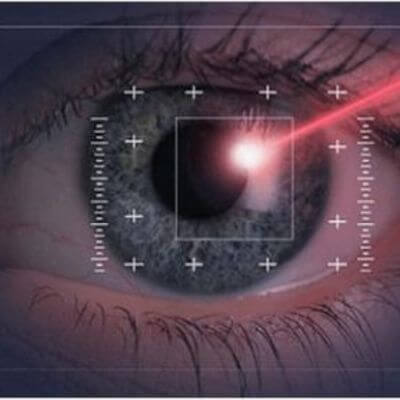 LASIK laser being beamed into a patient’s eye