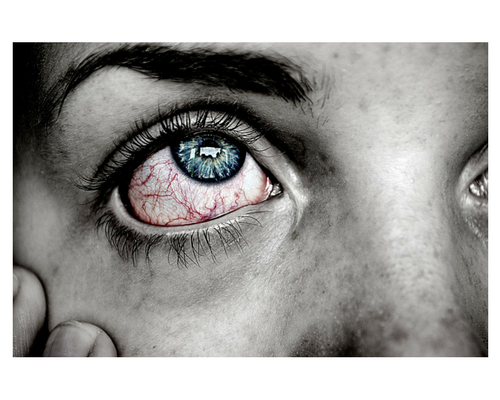 Don’t Risk Eye Damage with Halloween Contacts
