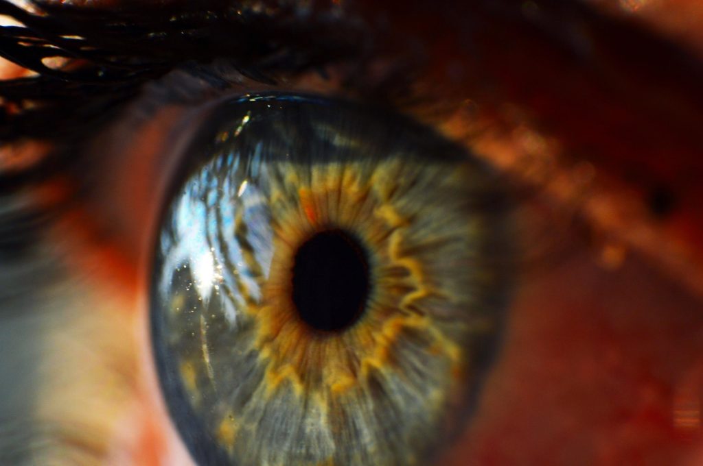 Up close image of the eye where a corneal ulcer would develop