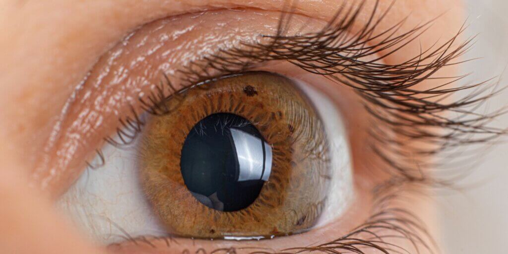 damaged cornea symptoms